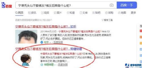 霸屏新陣地，1分鐘百度收錄并排首頁技術